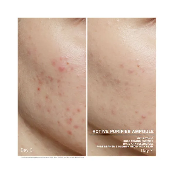 Babor Ampollas Active Purifier 14ml